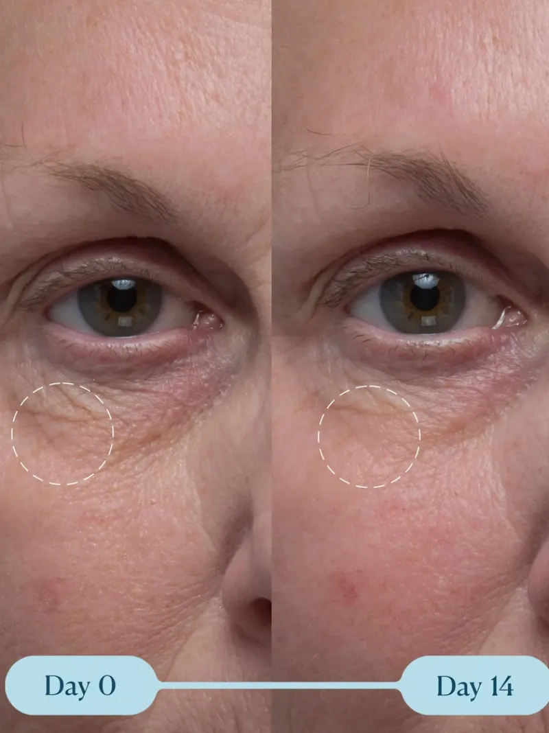 elemis_procollagen_vitali_2.webp ELEMIS Pro-Collagen Vitality Eye Cream | MECCA Outlet