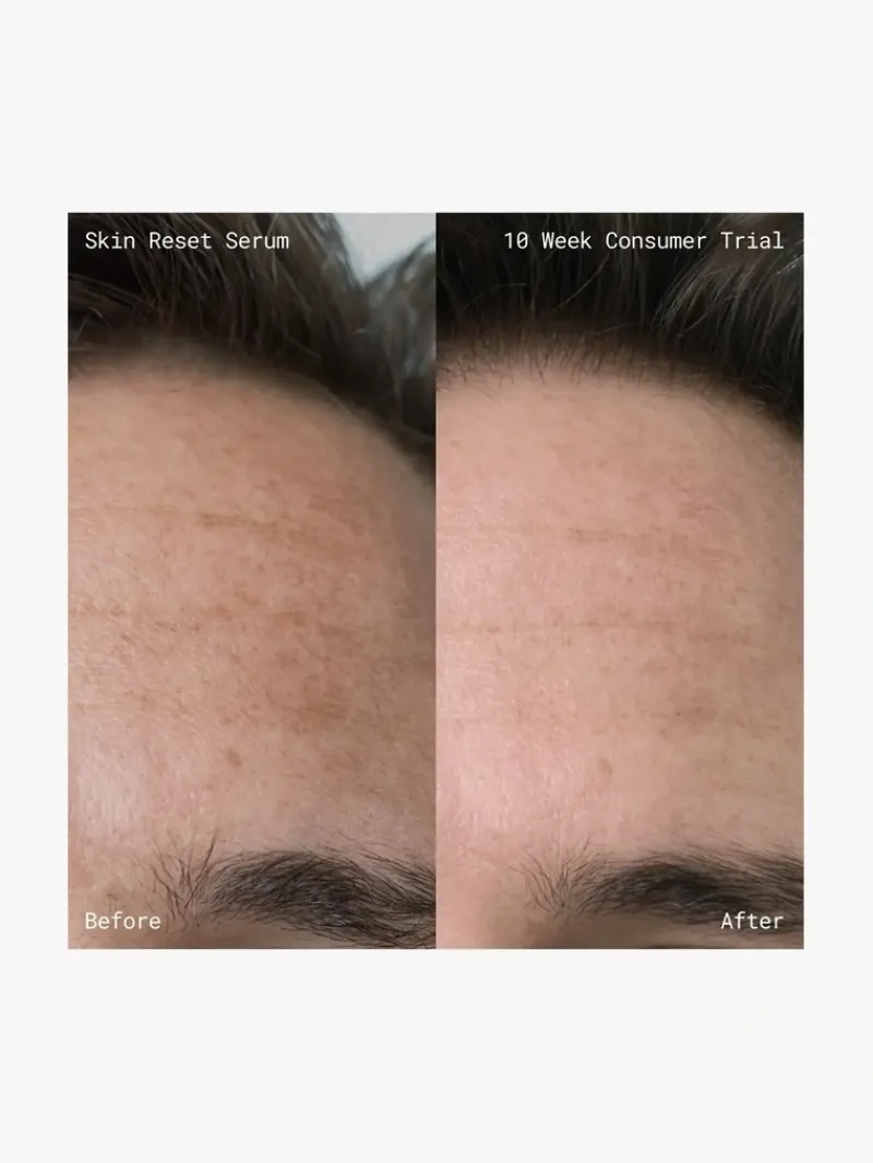 emma_lewisham_skin_reset__4.webp Emma Lewisham Skin Reset Serum Refill | MECCA New