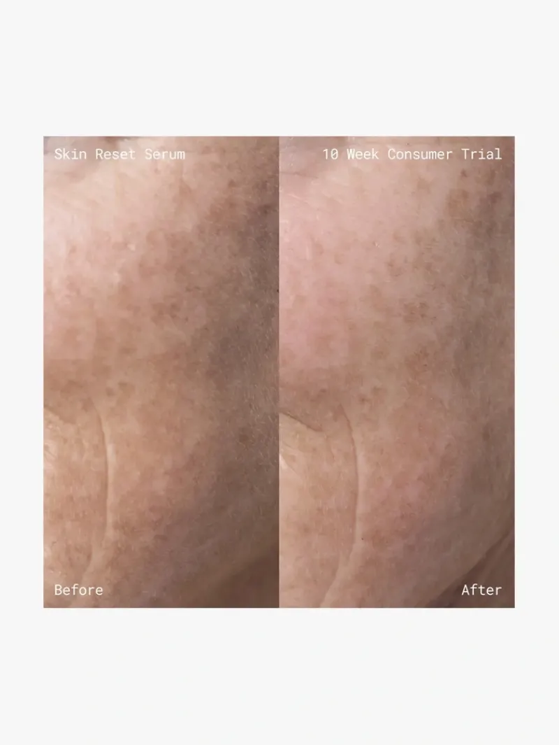 emma_lewisham_skin_reset__5.webp Emma Lewisham Skin Reset Serum Refill | MECCA New