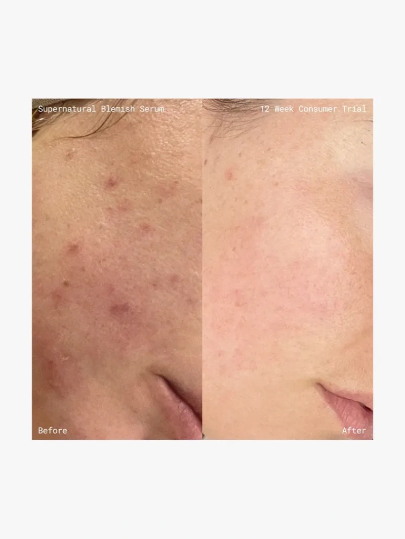 emma_lewisham_supernatura_4.webp Emma Lewisham Supernatural Blemish Face Serum | MECCA Online