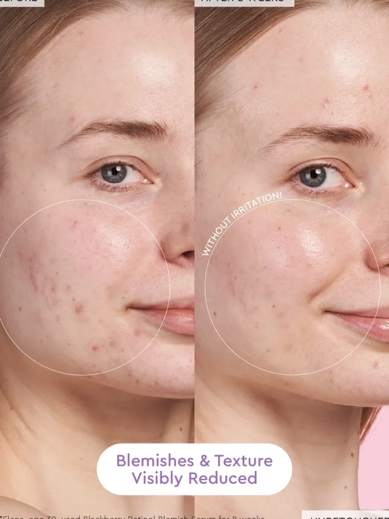 glow_recipe_blackberry_re_3.webp Glow Recipe Blackberry Retinol Serum | MECCA Outlet