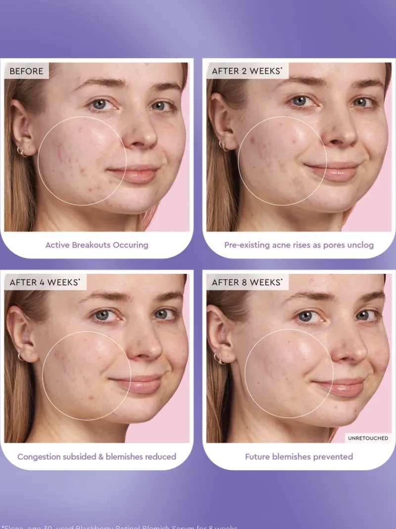 glow_recipe_blackberry_re_4.webp Glow Recipe Blackberry Retinol Serum | MECCA Outlet