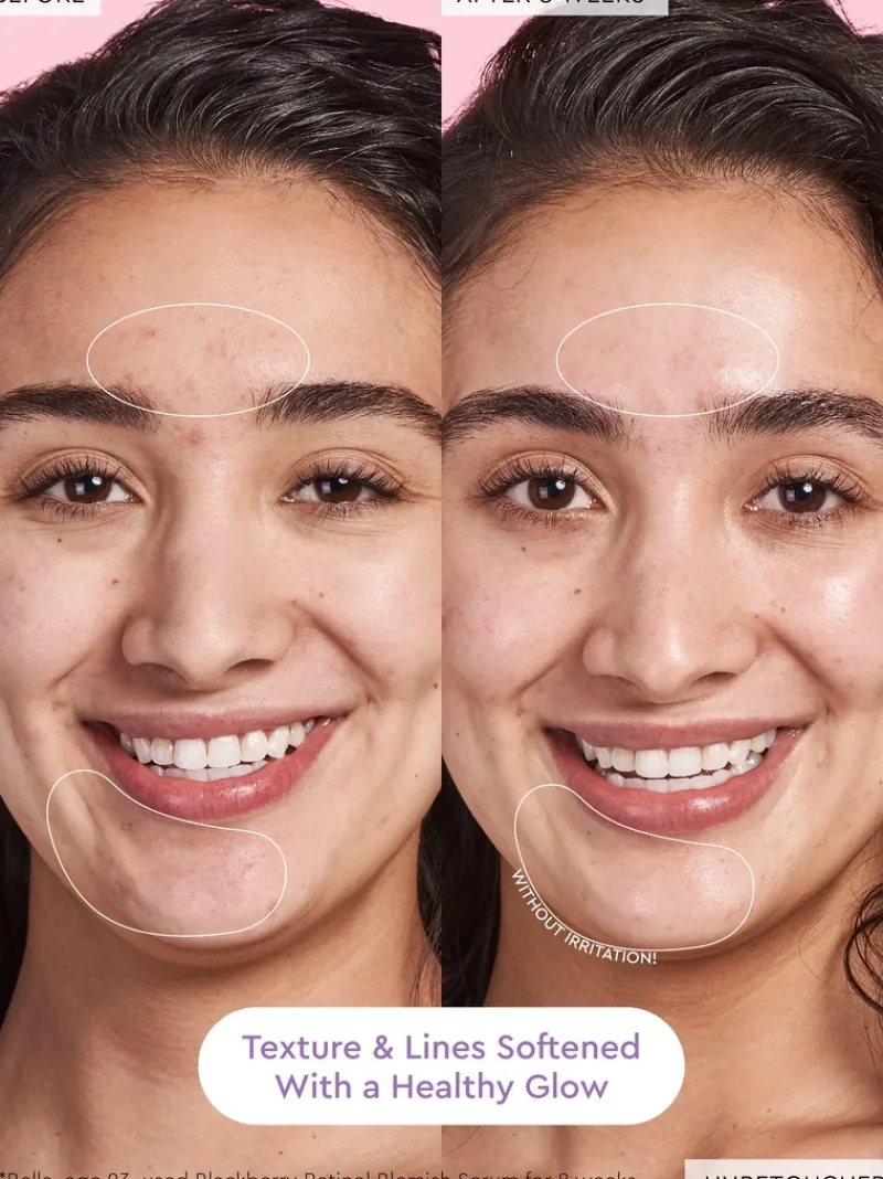 glow_recipe_blackberry_re_5.webp Glow Recipe Blackberry Retinol Serum | MECCA Outlet