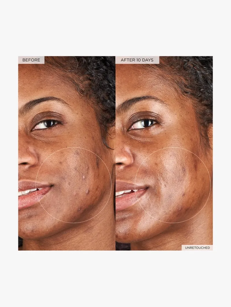 glow_recipe_watermelon_gl_3-4.webp Glow Recipe Watermelon Glow Hyaluronic Clay Pore-Tight Facial | MECCA New