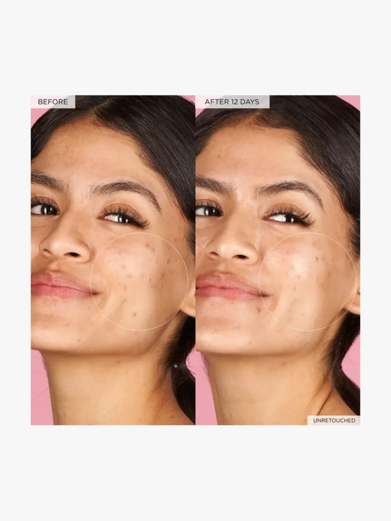 glow_recipe_watermelon_gl_4-4.webp Glow Recipe Watermelon Glow Hyaluronic Clay Pore-Tight Facial | MECCA New
