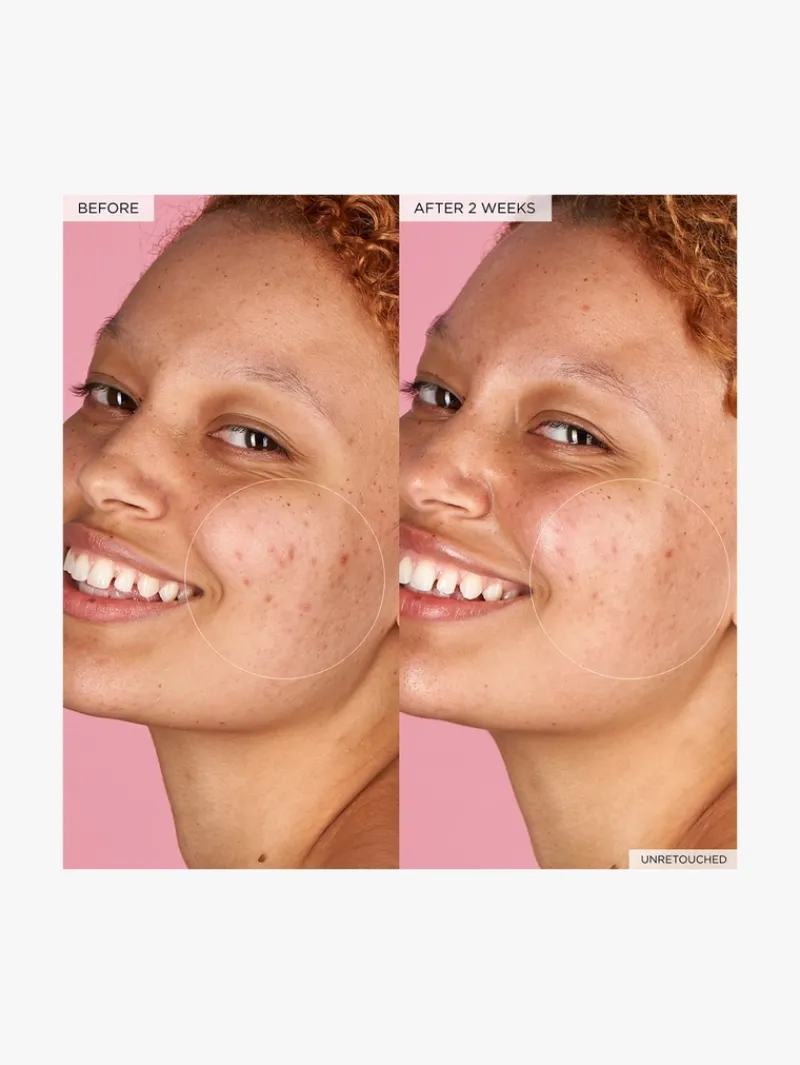 glow_recipe_watermelon_gl_5-1.webp Glow Recipe Watermelon Glow Hyaluronic Clay Pore-Tight Facial | MECCA New