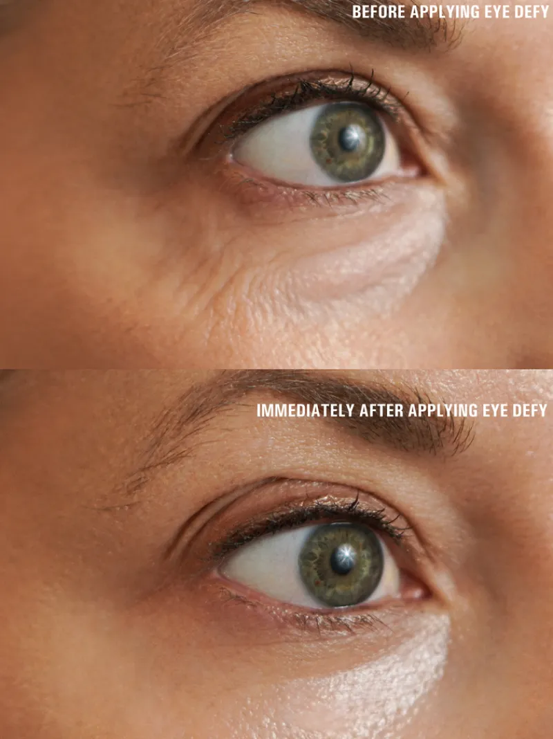 goldfaden_md_eyedefy_radi_5.webp Goldfaden MD EyeDefy Radiance Restoring Eye Treatment | MECCA Discount