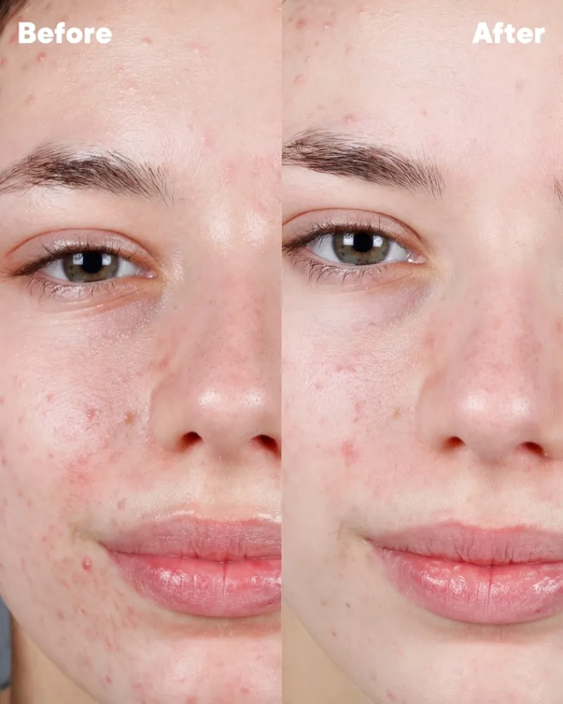 goto_clarifying_face_hero_6.webp Go-To Clarifying Face Hero | MECCA Fashion