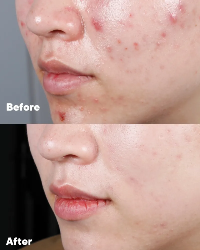 goto_clarifying_face_hero_7.webp Go-To Clarifying Face Hero | MECCA Fashion