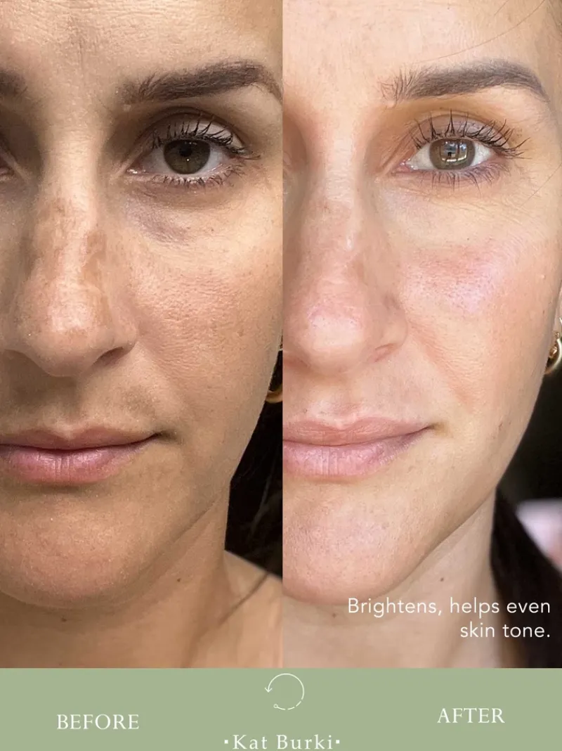 kat_burki_ph_enzyme_essen_3.webp Kat Burki PH+ Enzyme Essence | MECCA New