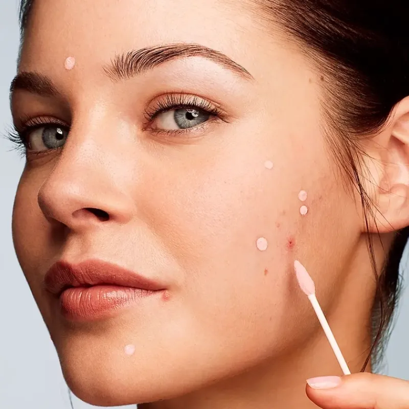 kate_somerville_eradikate_2-1.webp Kate Somerville EradiKate Acne Treatment | MECCA Online