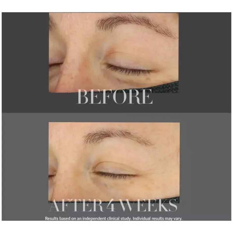 kate_somerville_lifting_e_4.webp Kate Somerville Lifting Eye Cream - KateCeuticals | MECCA Fashion