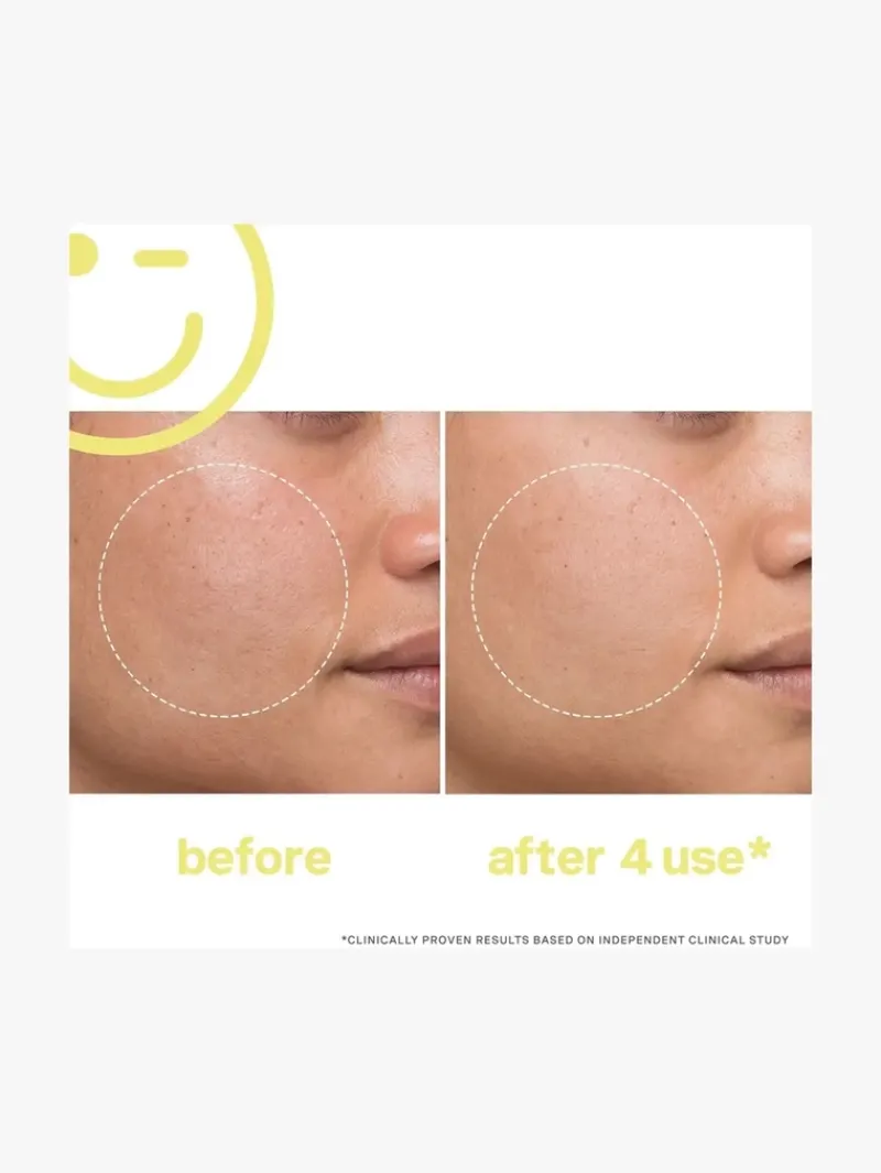 kate_somerville_mega_c__v_6.webp Kate Somerville Mega C 30% Vitamin C Brightening Facial | MECCA Outlet