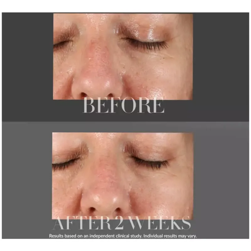 kate_somerville_resurfaci_3.webp Kate Somerville Resurfacing Overnight Peel KateCeuticals | MECCA New