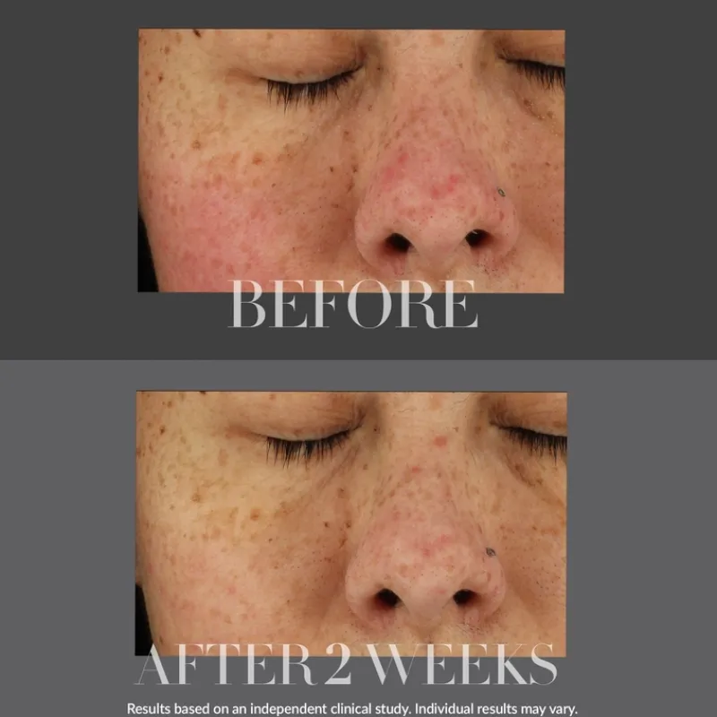 kate_somerville_total_rep_3.webp Kate Somerville Total Repair Cream KateCeuticals | MECCA Hot