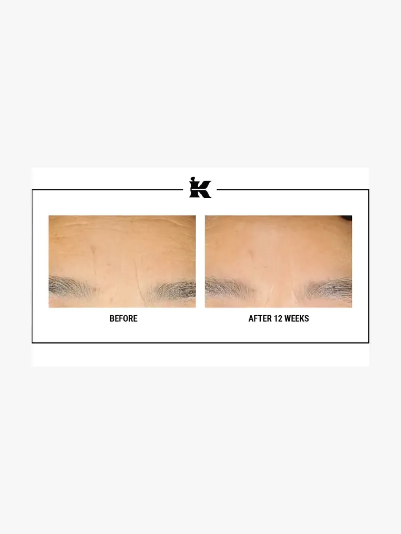 kiehlsxs_retinol_skinrene_6.webp Kiehl's Kiehls's Retinol Skin-Renewing Daily Micro-Dose Treatment | MECCA Online
