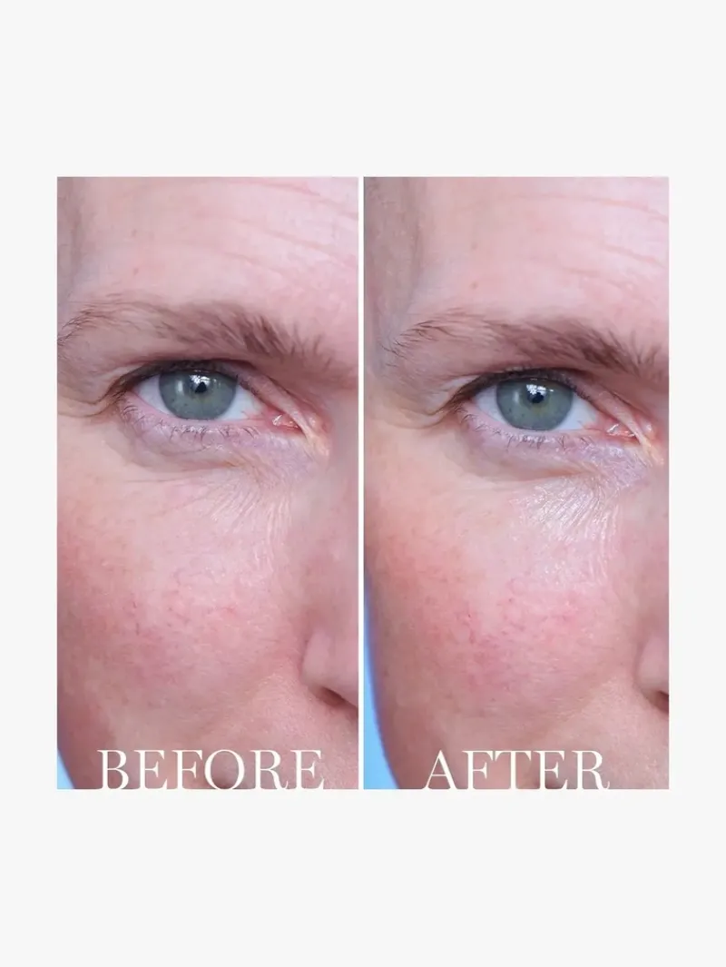 lancome_advanced_genifiqu_4.webp Lancome Advanced Genifique Eye Cream | MECCA Sale