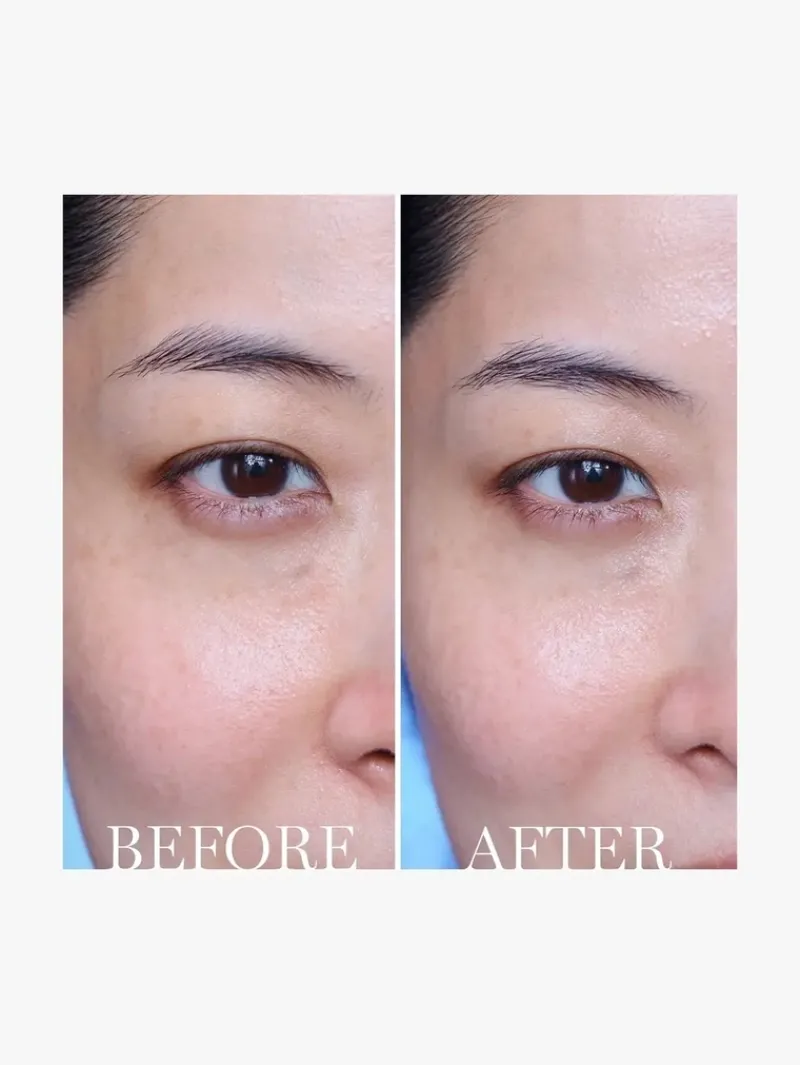lancome_advanced_genifiqu_6.webp Lancome Advanced Genifique Eye Cream | MECCA Sale