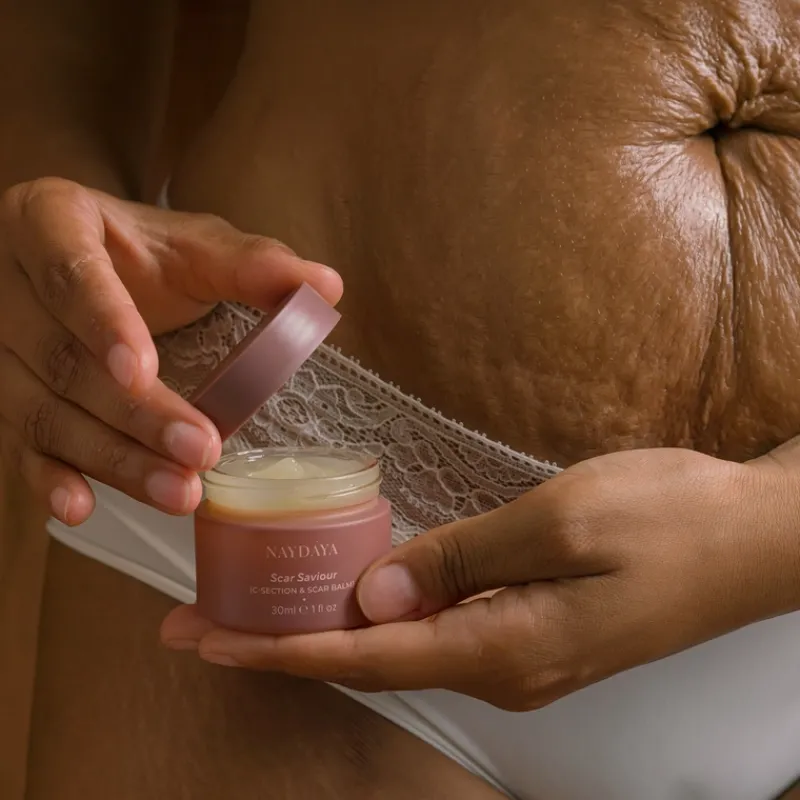 naydaya_scar_saviour_balm_3.webp Naydaya Scar Saviour Balm | MECCA Discount