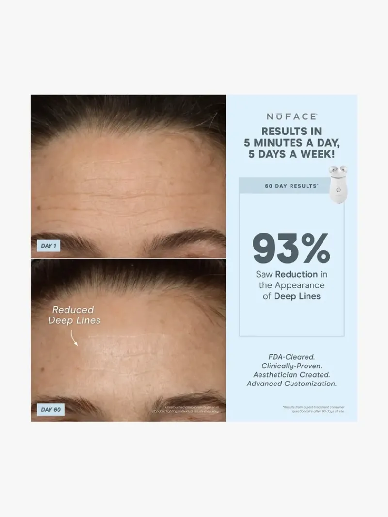 nuface_effective_lip_amp__9.webp NuFACE Effective Lip & Eye Attachment | MECCA Discount