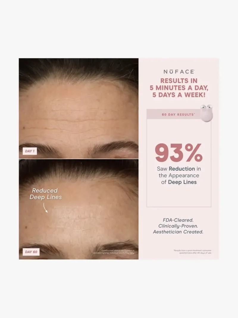 nuface_mini_starter_kit___8.webp NuFACE Mini+ Starter Kit | MECCA Online