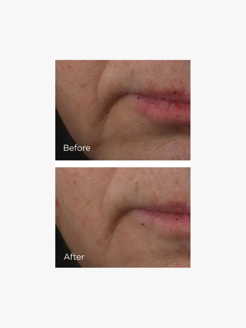 perricone_md_cold_plasma__3-1.webp Perricone MD Cold Plasma Plus Advanced Face Serum | MECCA Online
