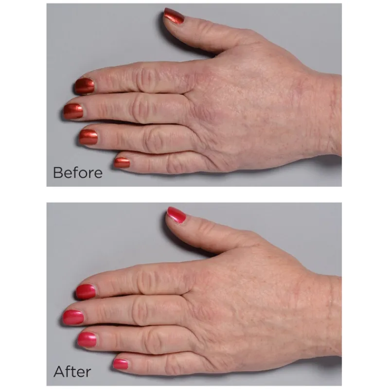 perricone_md_cold_plasma__3-5.webp Perricone MD Cold Plasma Plus + Hand Therapy | MECCA Discount