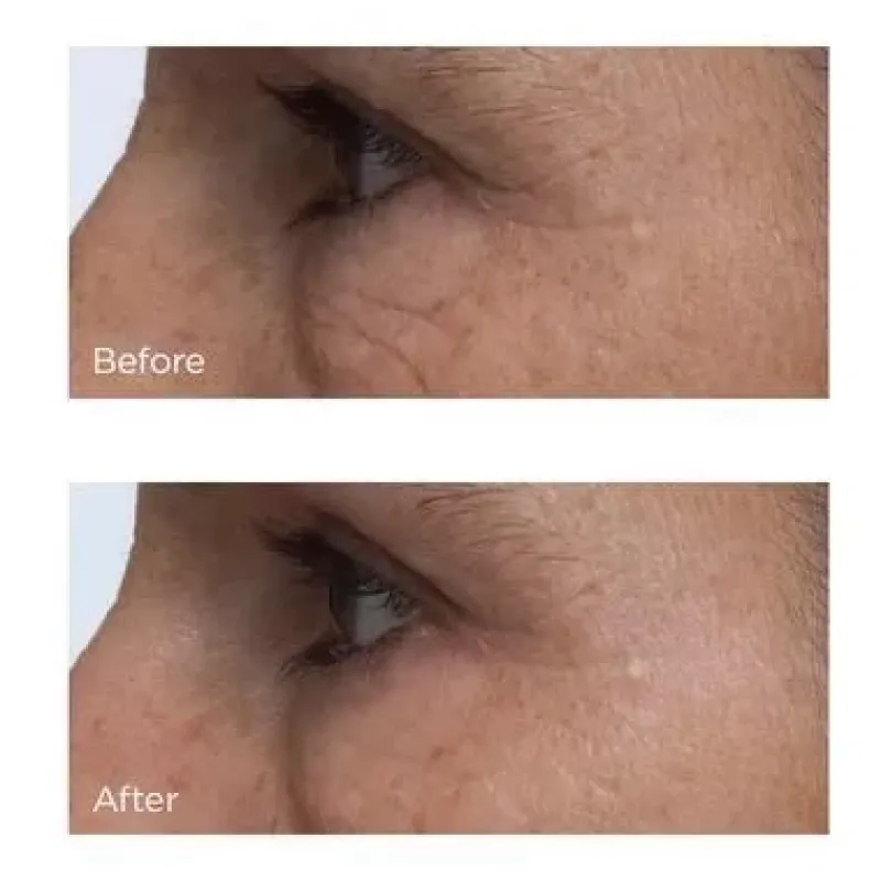 perricone_md_cold_plasma__4-1.webp Perricone MD Cold Plasma+ Eye | MECCA Fashion