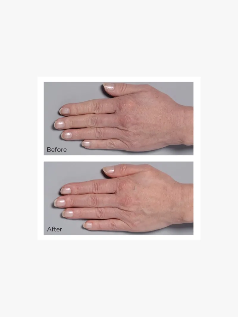 perricone_md_cold_plasma__4-2.webp Perricone MD Cold Plasma Plus + Hand Therapy | MECCA Discount