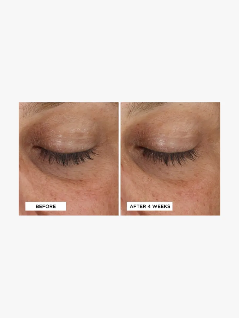 perricone_md_cold_plasma__5-1.webp Perricone MD Cold Plasma+ Eye | MECCA Fashion