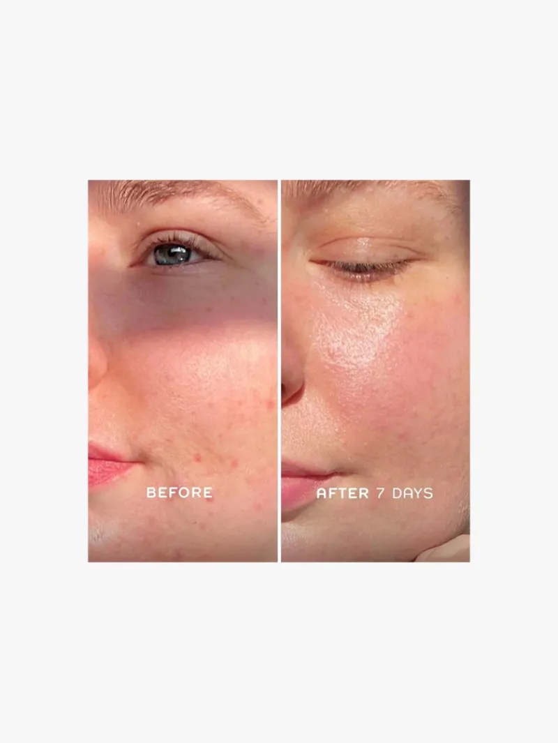 ren_clean_skincare_everca_1-1.webp REN Clean Skincare Evercalm Repair Complex | MECCA Outlet