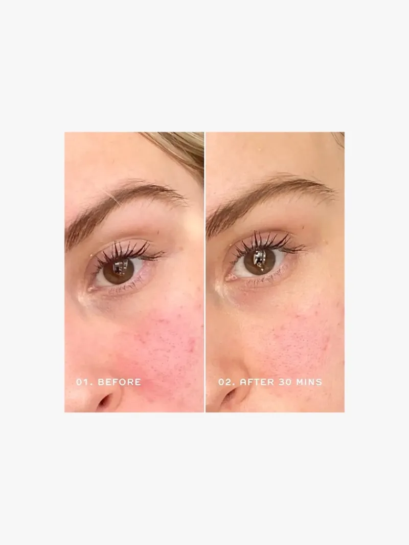 REN Clean Skincare Evercalm Redness Relief Serum | MECCA Discount