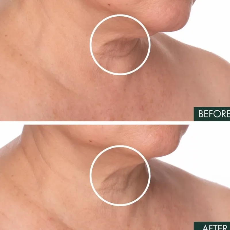 rvive_fermitif_neck_renew_3.webp RéVive Fermitif Neck Renewal Serum Firming Treatment | MECCA Discount