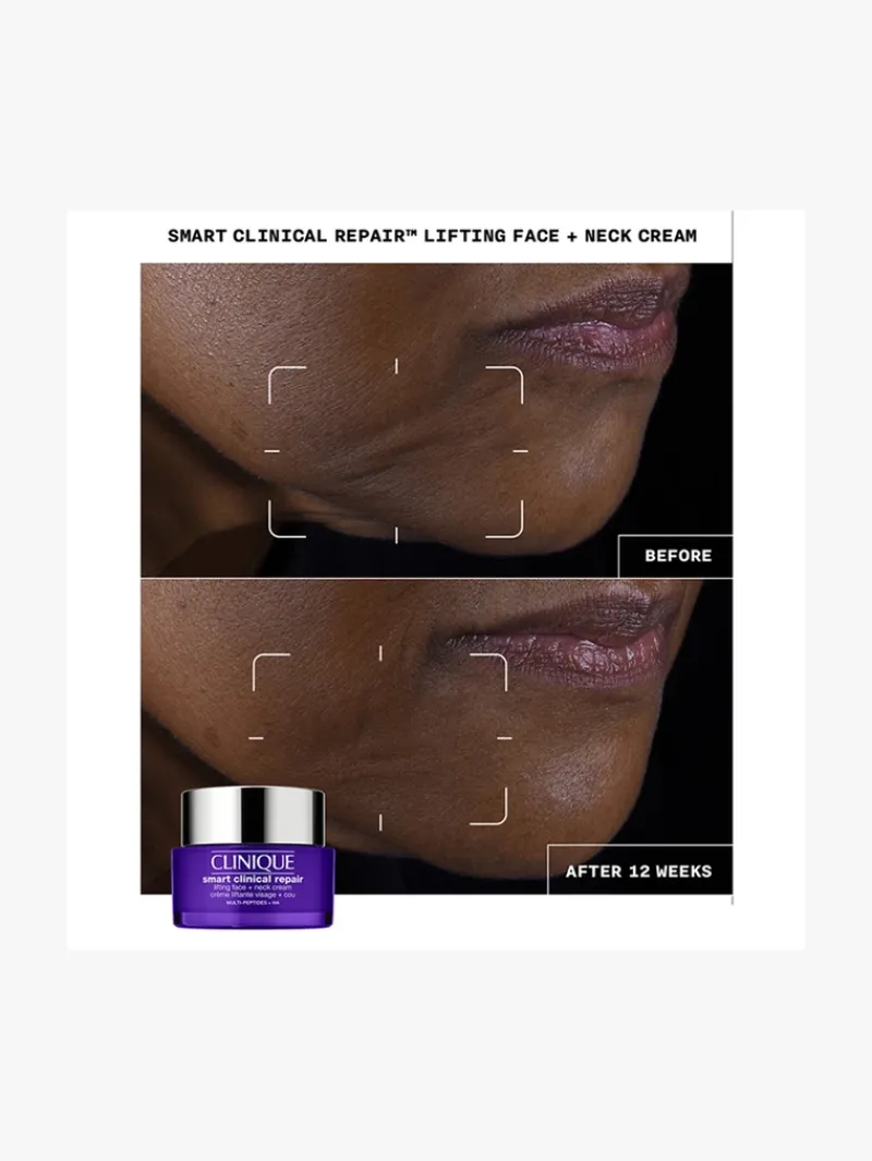 Clinique Shop Smart Clinical Repair Lifting Face + Neck Cream - | MECCA Sale