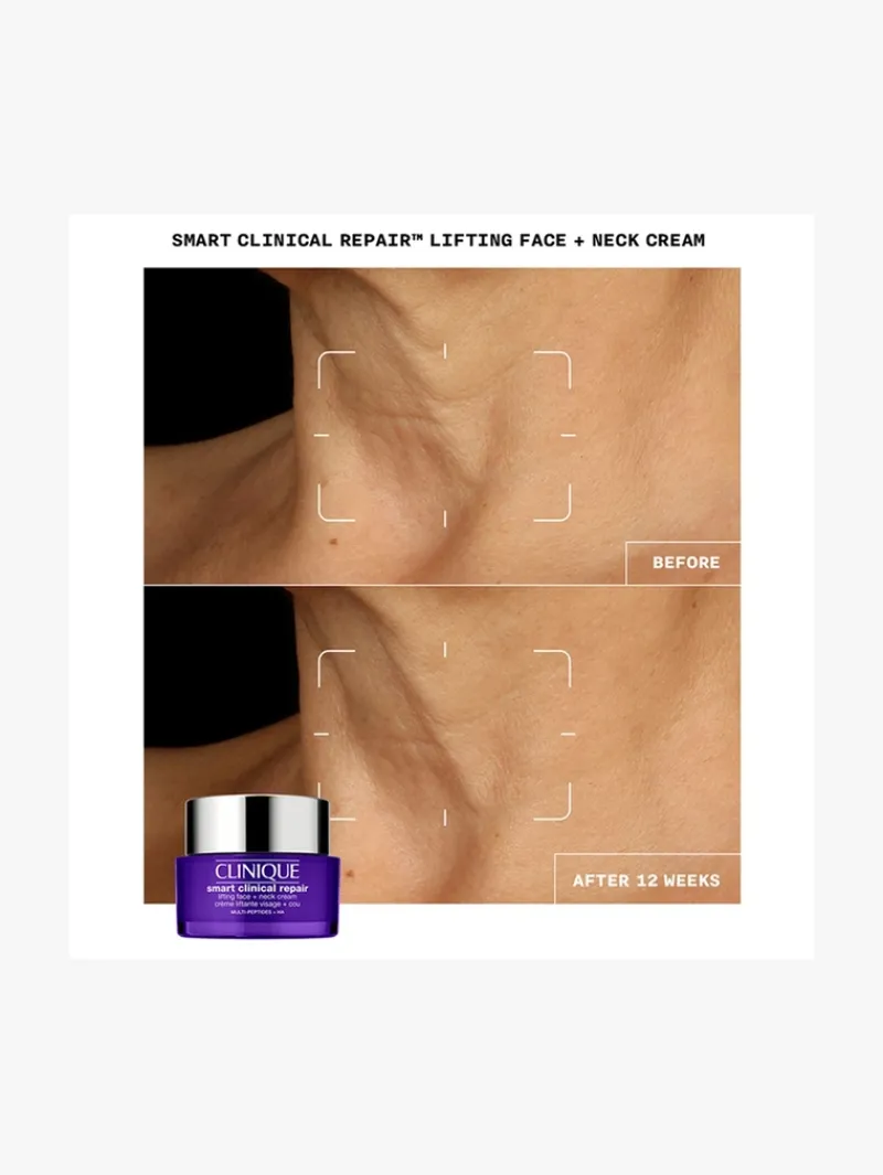 shop_smart_clinical_repai_3.webp Clinique Shop Smart Clinical Repair Lifting Face + Neck Cream - | MECCA Sale