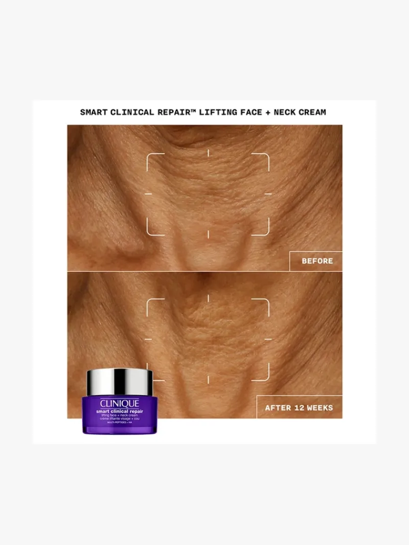 shop_smart_clinical_repai_4.webp Clinique Shop Smart Clinical Repair Lifting Face + Neck Cream - | MECCA Sale