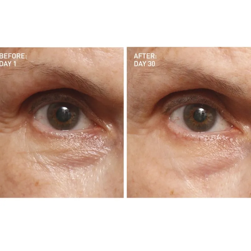 skyn ICELAND Icelandic Relief Eye Cream | MECCA Best
