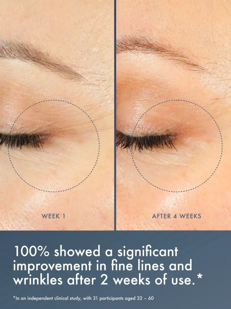 summer_fridays_jet_lag_ov_5.webp Summer Fridays Jet Lag Overnight Eye Serum | MECCA Discount