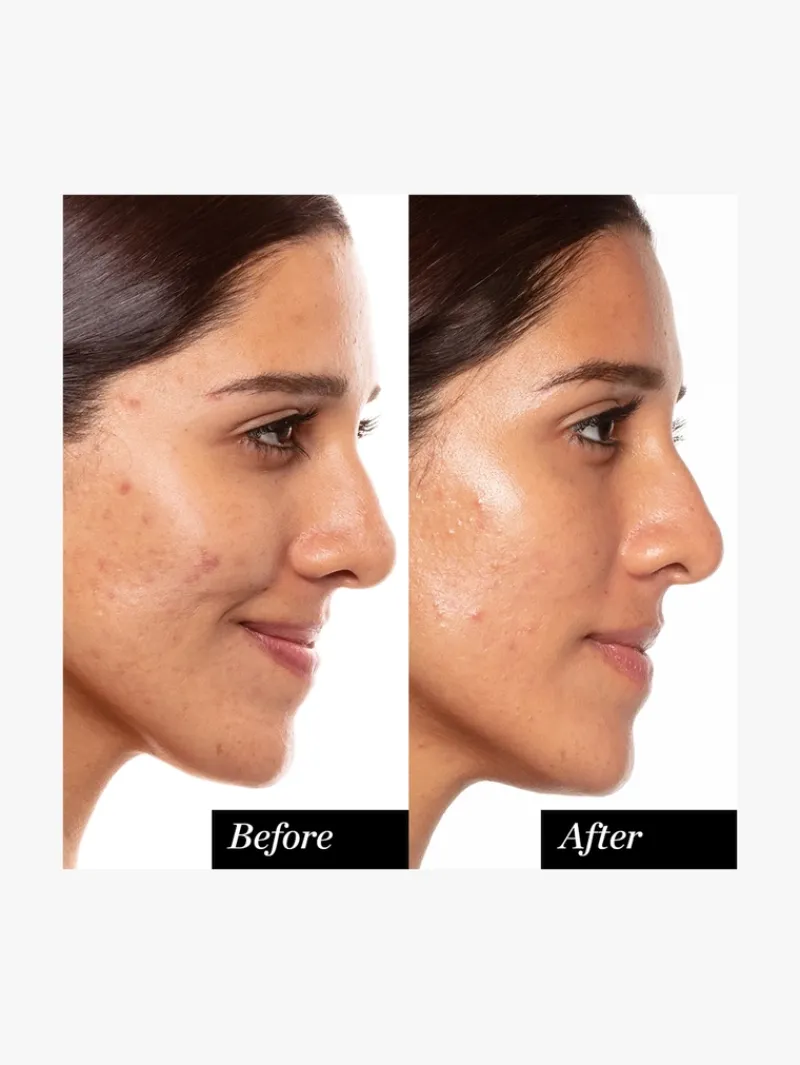 sunday_riley_a_highdose_r_2.webp Sunday Riley A+ High-Dose Retinoid Serum | MECCA Fashion