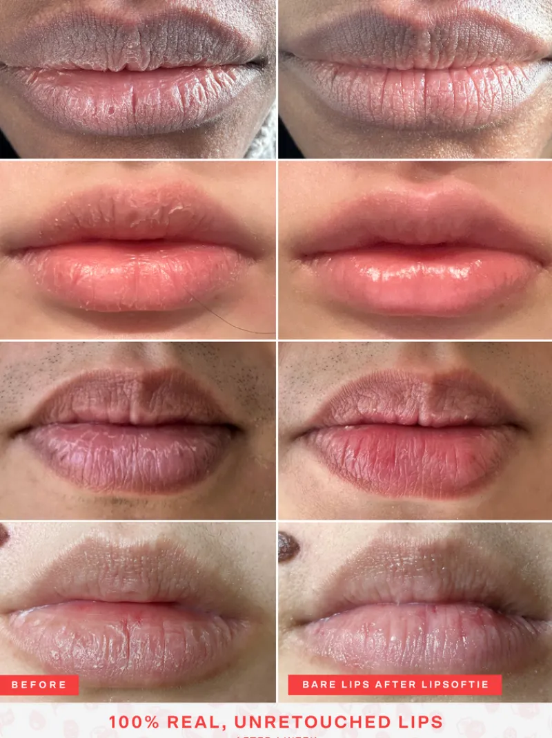 tower__lipsoftie_rescue_l_6.webp Tower 28 LipSoftie Rescue Lip Treatment | MECCA Online
